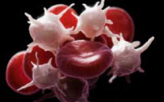 Как уменьшить количество тромбоцитов в крови