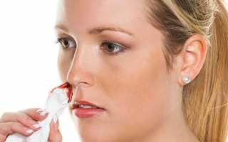 Причина кровь из носа у взрослого человека