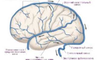 Асимметрия венозного оттока головного мозга
