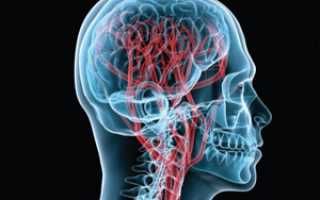 Зачем исследовать сосуды головного мозга и как проверить их состояние?