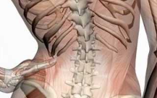 Мышечная невралгия — когда болью сводит мышцы спины, груди и все остальные