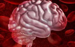 Признаки кровоизлияния в голове у взрослого