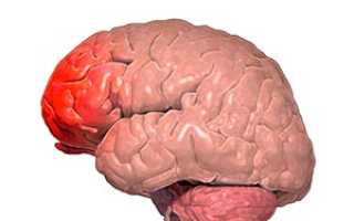 Мозжечковый синдром, как симптом и следствие неврологических нарушений