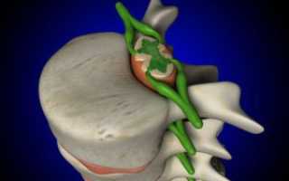 Травма спинного мозга: первая помощь, восстановление и последствия