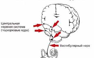 Как выяснить вид и причины головокружения и избавиться от него