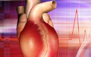 Воспаление сердечной мышцы симптомы у взрослых