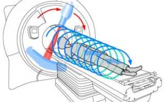 Что такое спиральная компьютерная томография и как проводится СКТ головного мозга
