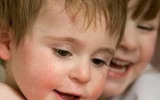 Есть ли шансы у ребенка с синдромом Отахара
