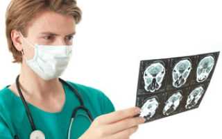 КТ, МР и церебральная ангиография сосудов головного мозга — процесс исследования и цена