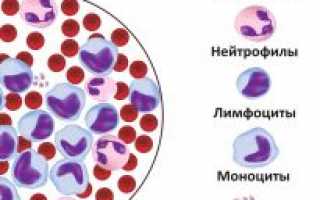 Показатели анализа крови при лейкозе у взрослых