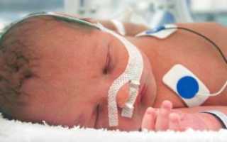Внутрижелудочковое кровоизлияние у новорожденных: как снизить риски и последствия?