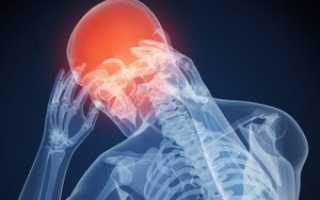 Что делать если от перенапряжения донимает головная боль