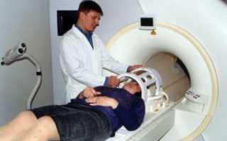Позитронно-эмиссионная томография головного мозга в неврологии