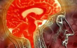 Опасное вирусное заболевание энцефалит головного мозга —  трудное лечение и тяжелые последствия