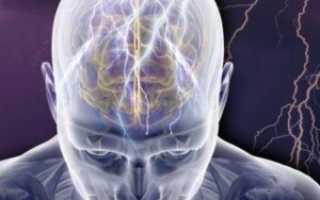 Парциальная эпилепсия — точечный, но опасный мозговой удар