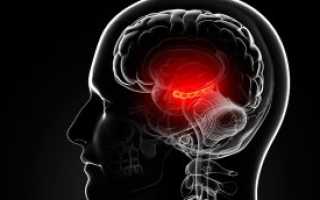 Киста гипофиза: причины, симптомы и лечение опухоли головного мозга этой области